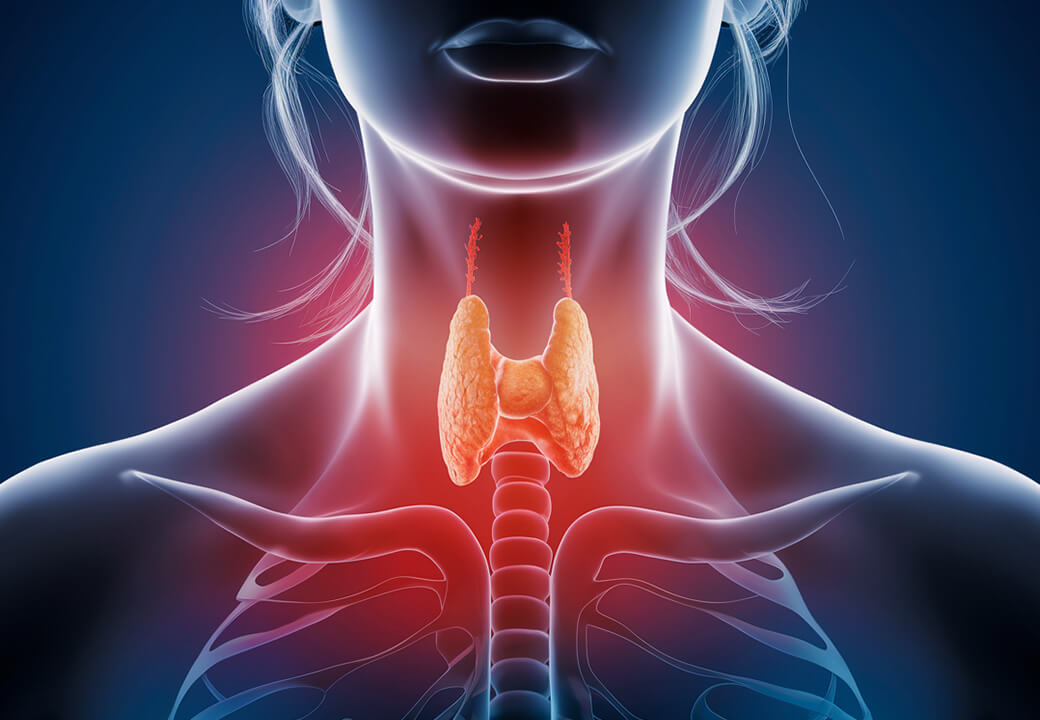 Niedobór jodu w organiźmie? Jak działać aby nie brakowało jodu. Sprawdź na Twoj Cel To.